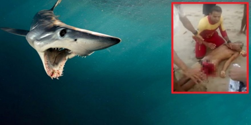Köpekbalığı cinsel organını kopardı!