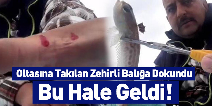 Oltasına Takılan Zehirli Balığa Dokundu Bu Hale Geldi!