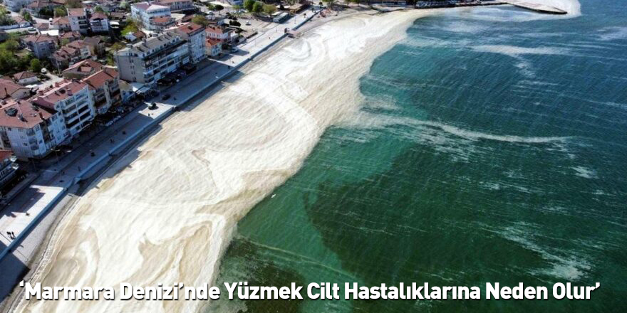 ‘Marmara Denizi’nde Yüzmek Cilt Hastalıklarına Neden Olur’