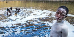 Bu göle her gün çırılçıplak giriyorlar